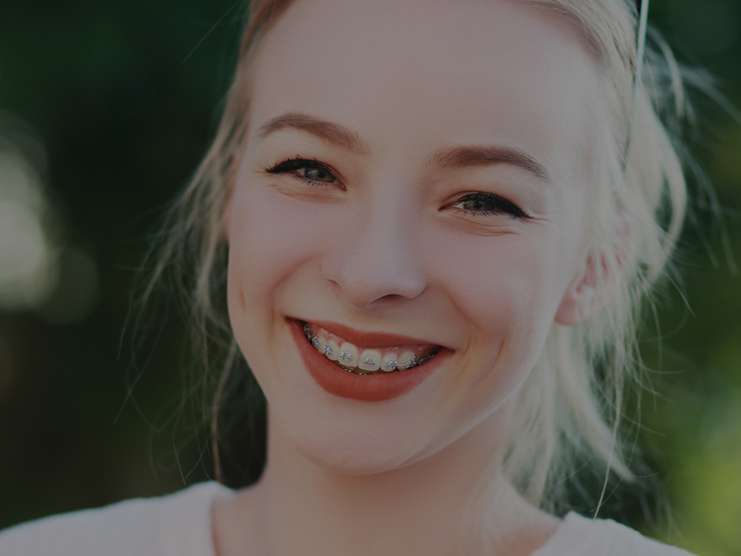 Orthodontic options
