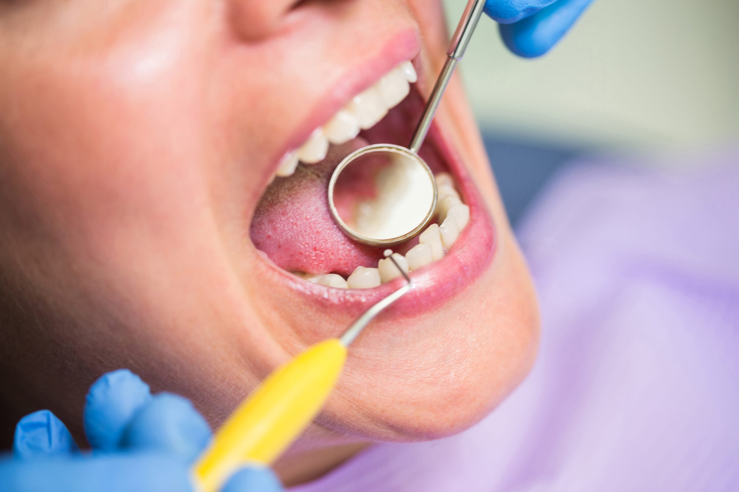 Dental Abscess Treatment in Turramurra
